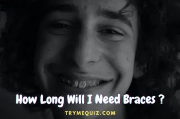 How Long Will I Need Braces