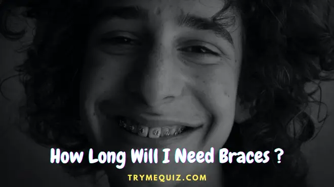 How Long Will I Need Braces