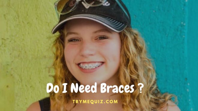 Do I Need Braces Quiz