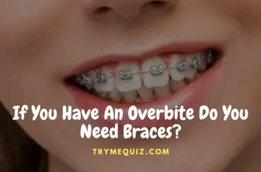 If You Have An Overbite Do You Need Braces