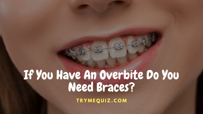 If You Have An Overbite Do You Need Braces